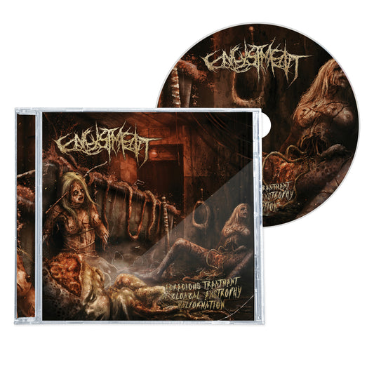 ENCYSTMENT "EGREGIOUS TREATMENT OF CLOACAL EXCTROPHY MALFORMATION" CD