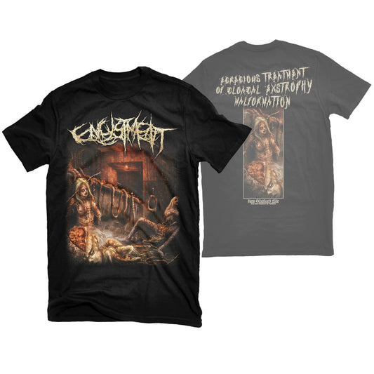 ENCYSTMENT "EXTROPHY" T-SHIRT