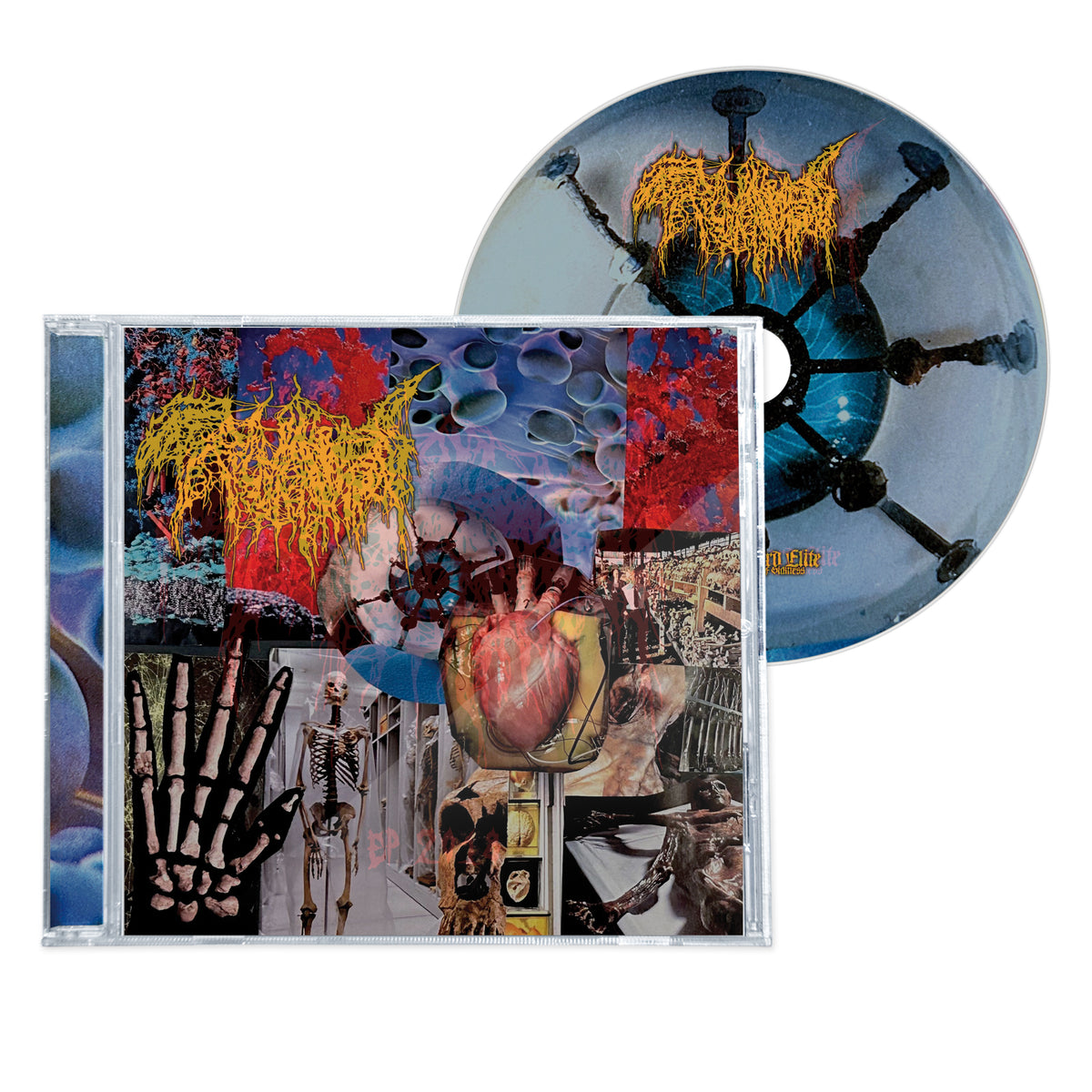 TRICHOMONIASIS "HARVEST OF THE KILLING FIELDS" CD
